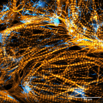 Un'immagine più dettagliata delle strutture di citoscheletro di actina. Immagine acquisita da Till Stephan.