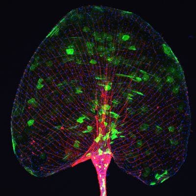 Fruit fly under the microscope