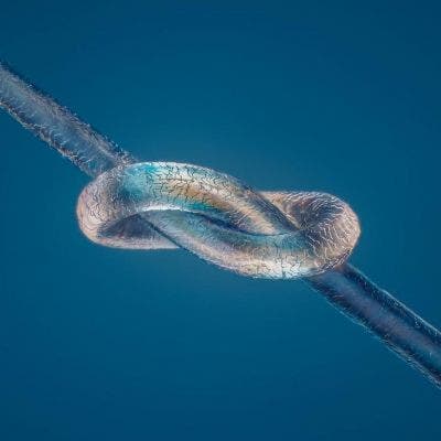 Hair under the microscope