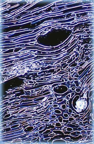 Immagine di microscopia in campo oscuro del DNA liquido-cristallino.