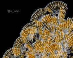 Licmophora diatom arrangement under the microscope