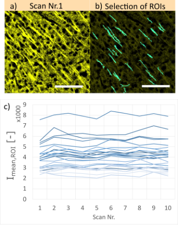 Figura 7. a) Esempio di un campione di cervello di topo (con colorazione Cy3, spessore 100 µm) acquisito mediante imaging VS-SILA con un ST pari a 10 a un ingrandimento di 40X.