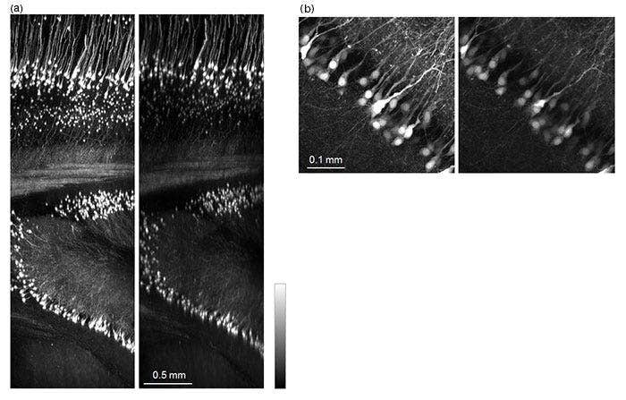Figure 5: Mouse brain (Thy1-YFP-H mouse）cleared with ScaleA2.