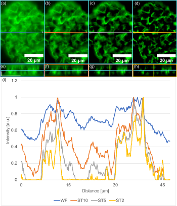 Figura 5. Miglioramento del sezionamento ottico usando l'illuminazione VS-SILA rispetto a WF.