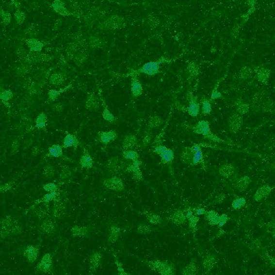 Calcium imaging: chemical indicator Fluo-3 in neuronal cells.