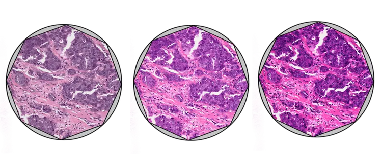 Come allineare l'illuminazione Köhler in sei semplici operazioni