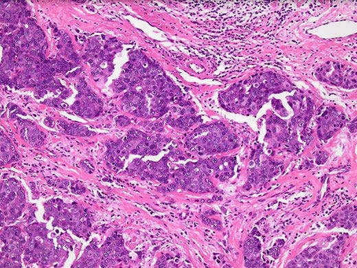 Fast HD Microscope Camera