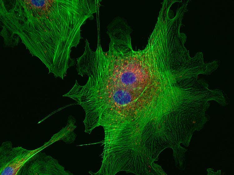 Fluorescence image captured using high contrast mode