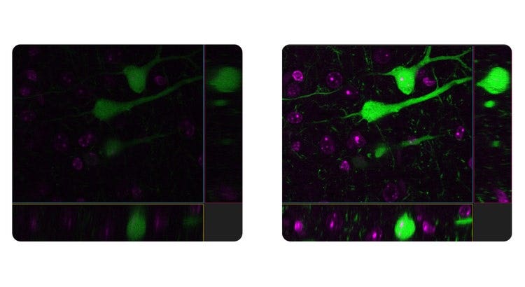 Comparison images without the TruResolution auto correction collar (left) and with the collar (right).