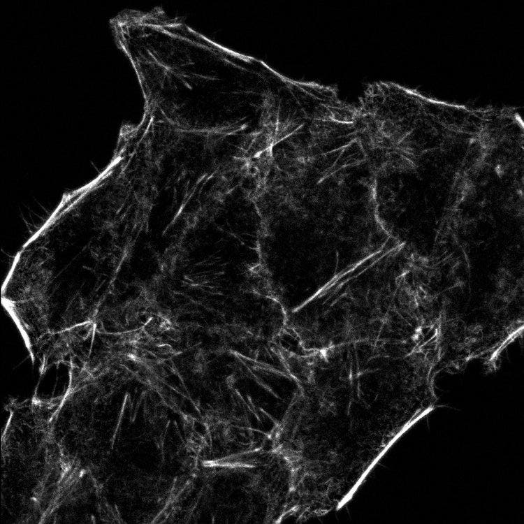 actin (AF750 phalloidin; gray)