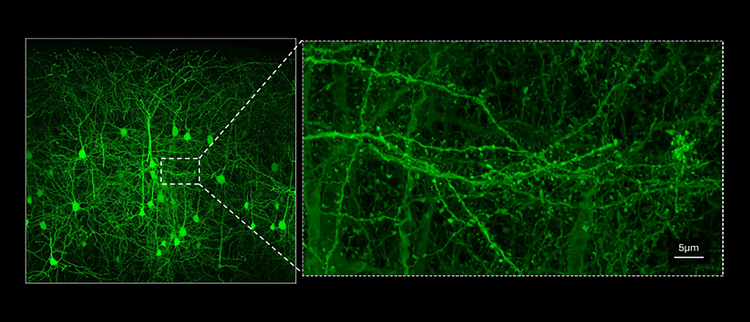 Unmatched dynamic range combined with effortless Nyquist, big picture, and fine details. Galvo 8192 × 8192, zoom 0.9x, 0.8 a.u., LUPLAPO25XO objective lens, Ypet: 514 / 530-570, Z: 60-150 µm, Z step: 0.82 µm, MIP.