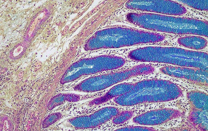 Brightfield image of a colon taken with the EP50 camera, a CX23 microscope, and 0.5X C-mount adaptor, 10X