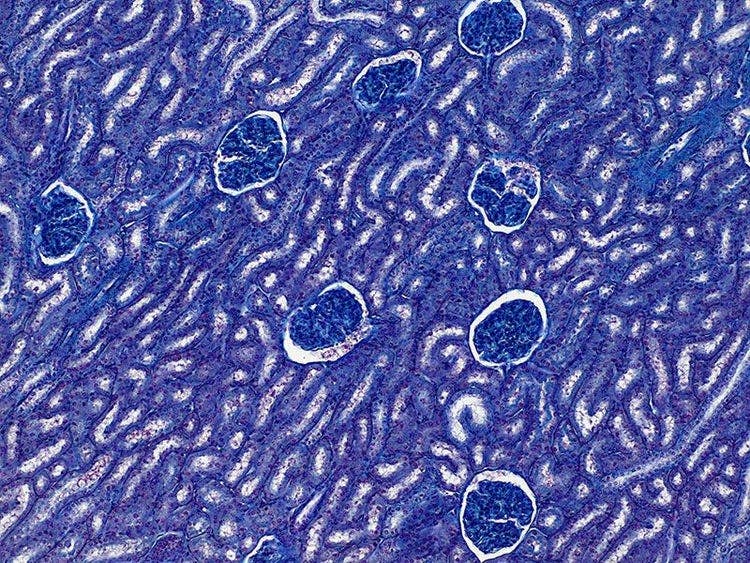 Specimen: Kidney glumeruli; Microscope: CX23, Objective: Plan Achromat 10x (NA 0.25), TV-Adaptor: U-TV0.5XC-3, Illumination: Brightfield (LED), Exposure time: 2 ms