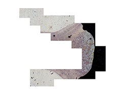 Lo stitching delle immagini digitali (manuale o automatico) permette di ampliare il campo visivo per analizzare ampie aree di interesse