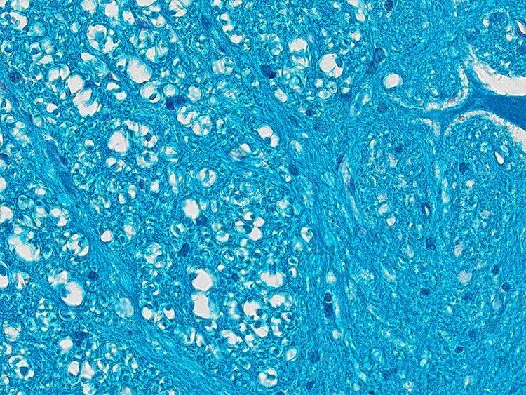 Specimen: Spinal cord; Microscope: CX23, Objective: Plan Achromat 40x (NA 0.65), TV-Adaptor: U-TV0.5XC-3, Illumination: Brightfield (LED), Exposure time: 8.1 ms