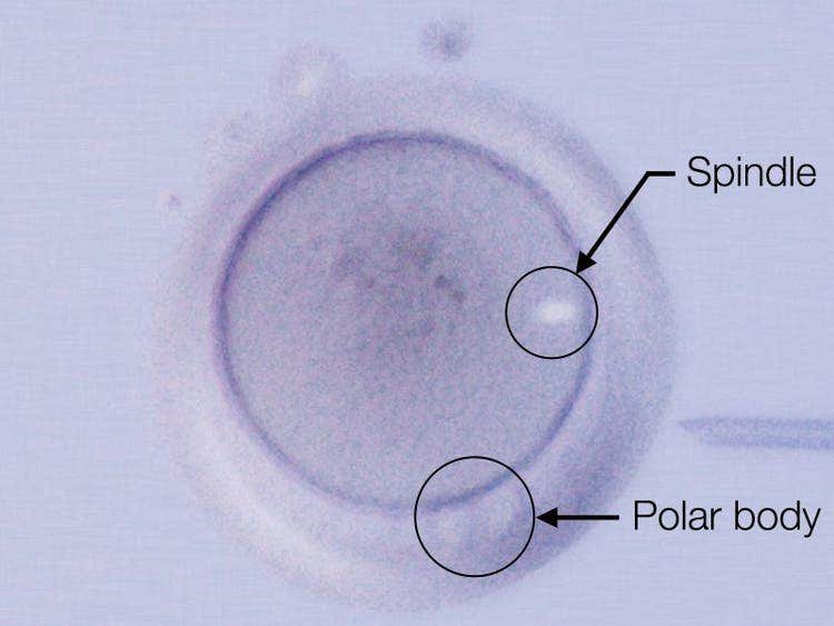 Spindle / Polar body