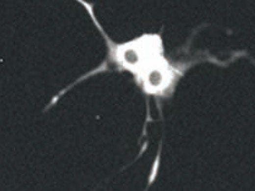 Higher Resolution Imaging