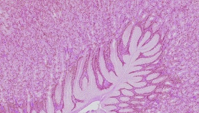 Immagini da sinistra a destra: citologia su strato sottile (ThinPrep Pap test), istologia su epitelio semplice (stomaco, EE)