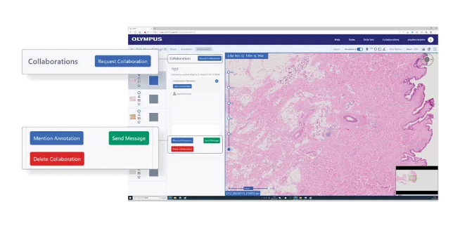 Collaborazione a distanza