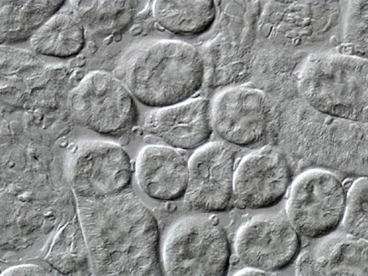 Mouse kidney thin section