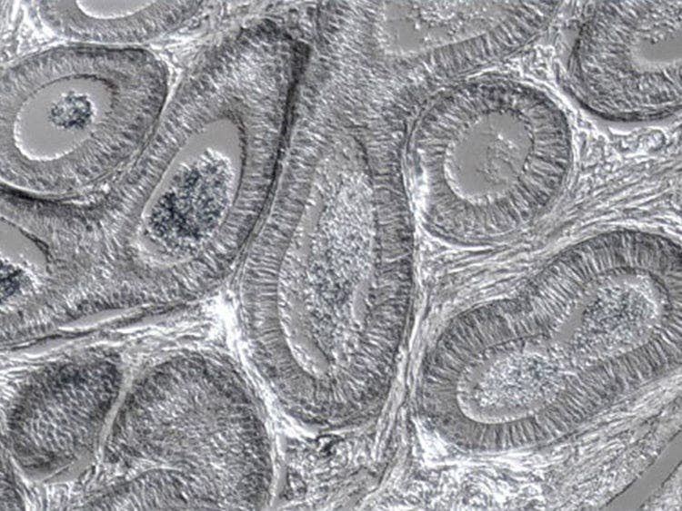 Intestine thin section