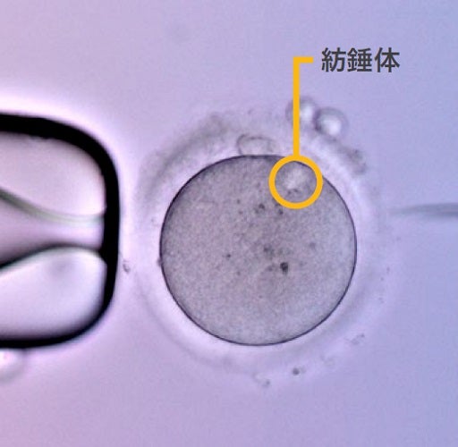 Spindle (Polarizing observation)