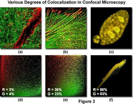 Confocal Microscopy - Colocalization of Fluorophores in Confocal ...