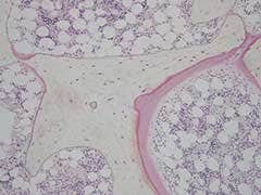 図５ 骨切片の明視野像