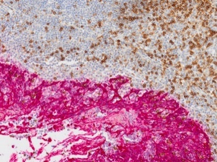 がん・幹細胞研究