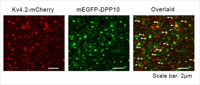 Kv4.2 - DPP10 チャネル複合体の1分子蛍光イメージング画像