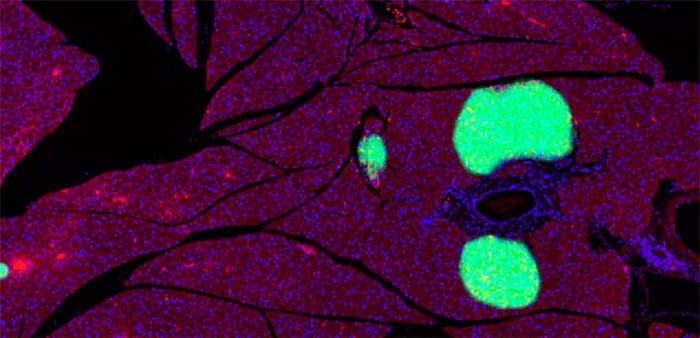 学習フェーズを経て確立したDNNによって膵島を自動で検出し区別します。