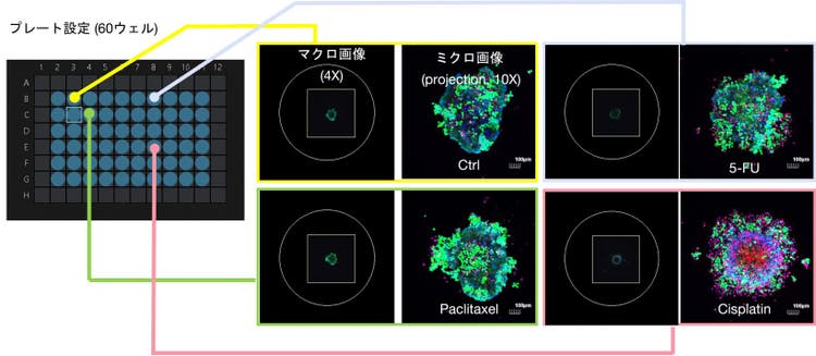 図２．抗がん剤の薬効試験に対する自動マクロミクロ撮影オプションの適用事例