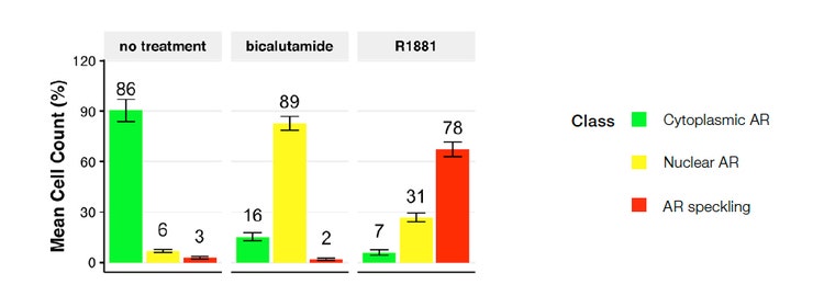 図 4:未処理（左）、ビカルタミド処理（中央）、R1881処理（右）を行ったもの。