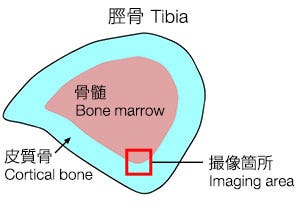 図1:脛骨の断面図
