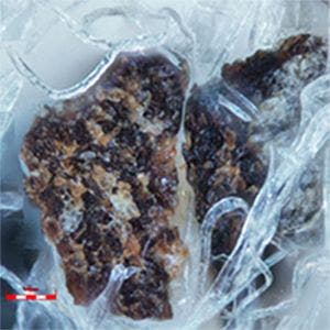 ハレーション除去あり