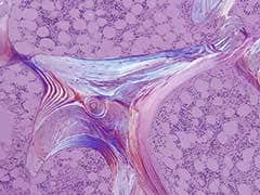 図４ 骨切片の偏光像（本法）