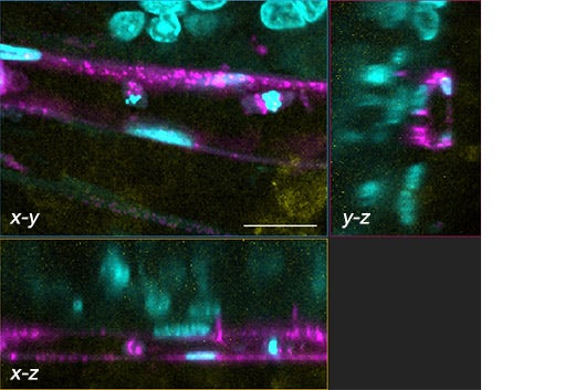 （b）（a）の白い長方形の領域の三次元断面（x-y、x-z、y-z）の画像。矢印は血管内腔を示す。スケールバーは50μm。対物レンズ：UPLSAPO40X2。