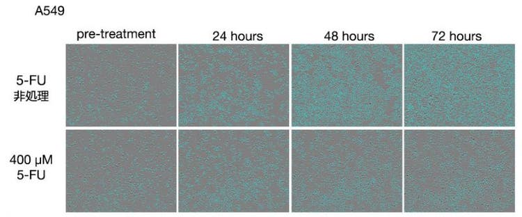 図1　5-FU処理後のA549細胞画像