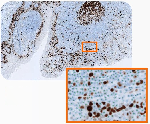 IHC核分類用の事前学習済みニューラルネットワーク
