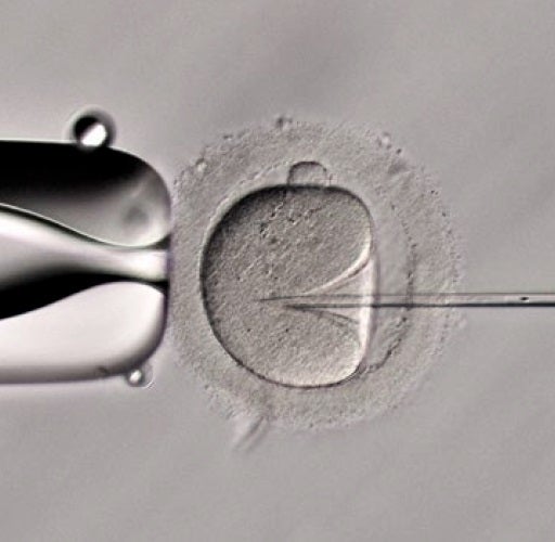 ICSI (Relief contrast)