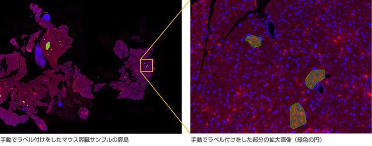 手動でラベル付けをしたマウス膵臓サンプルの膵島、手動でラベル付けをした部分の拡大画像（緑色の円）