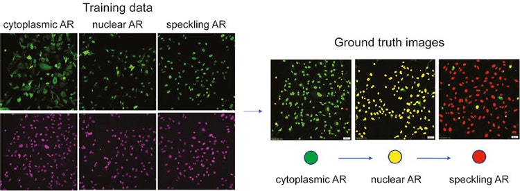 図 2: 核染色に基づくマルチクラスAR表現型学習データの準備。 （左）緑：AR-GFP、紫：SiR-DNA。 （右）教師画像の評価