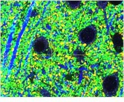 UPLASAPO60XS2, Z=5μm