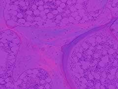 図２ 骨切片の偏光像（鋭敏色観察）