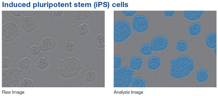 Cell analysis using machine learning