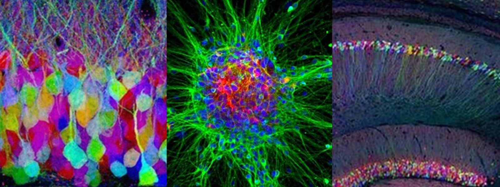 脳と花：2020年10月に人気だった顕微鏡画像 | オリンパス ライフサイエンス