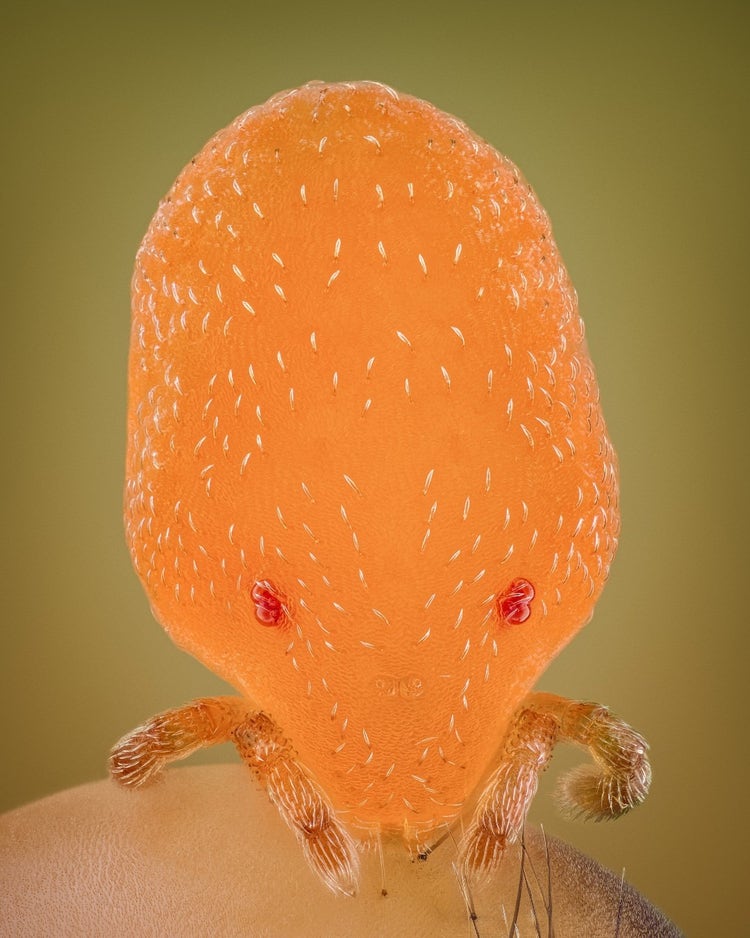 mite head