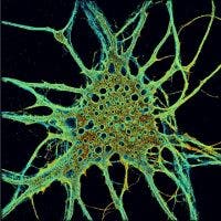 cytoskeleton