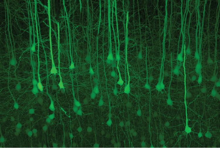 Mouse brain slice cleared with SeeDB2. EYFP cortical layer 5 pyramidal neurons in Thy1-YFP-H. Sample courtesy of: Drs. Satoshi Fujimoto and Takeshi Imai, Graduate School of Medical Sciences, Kyushu University.