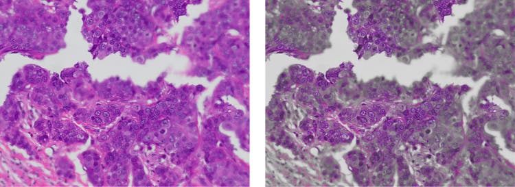 Focus peaking in microscope cameras